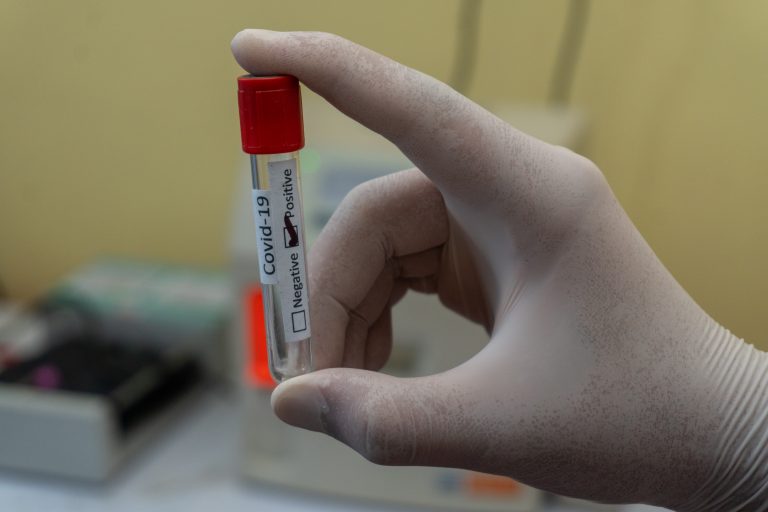 COVID 19 Masih Menjadi Misteri Di Indonesia