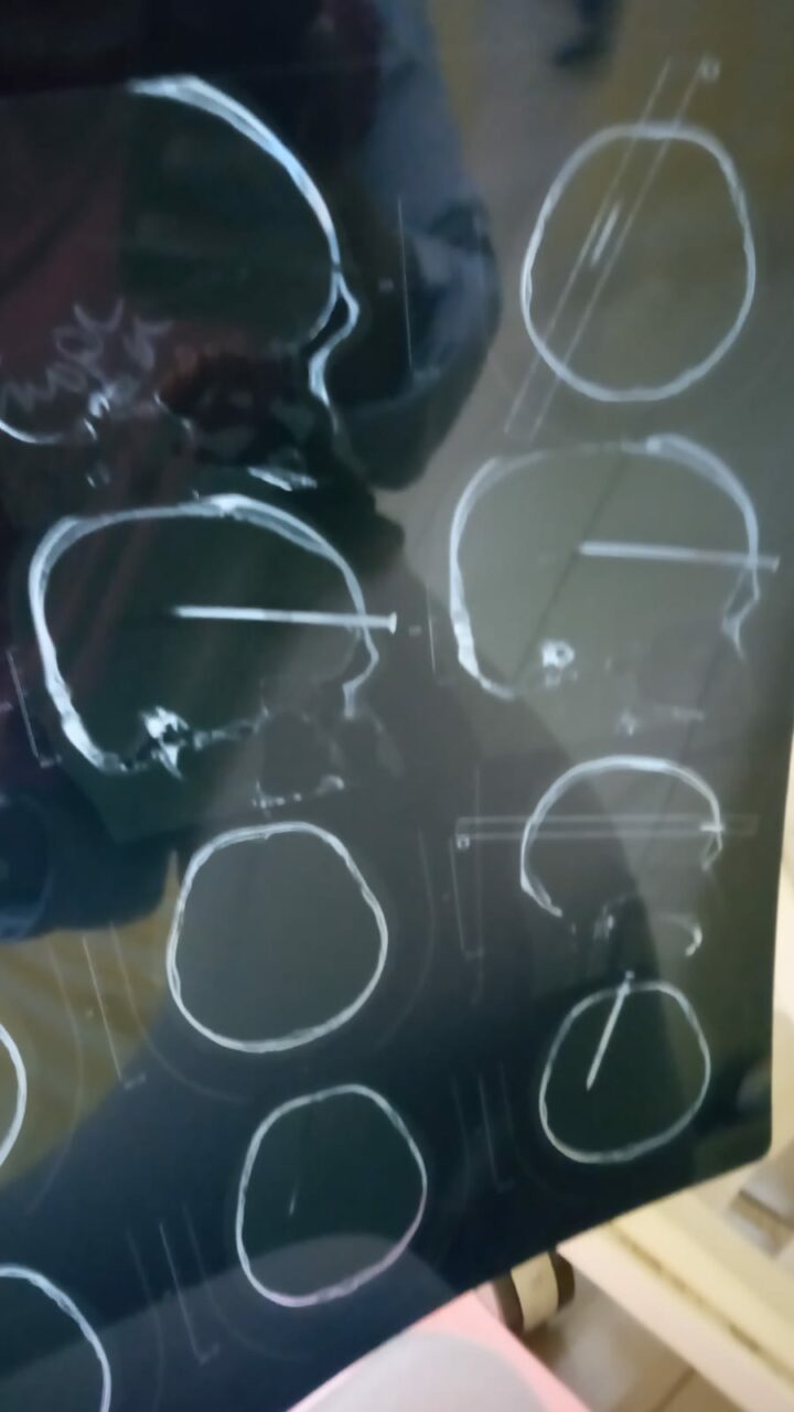 Hasil Rongten Korban