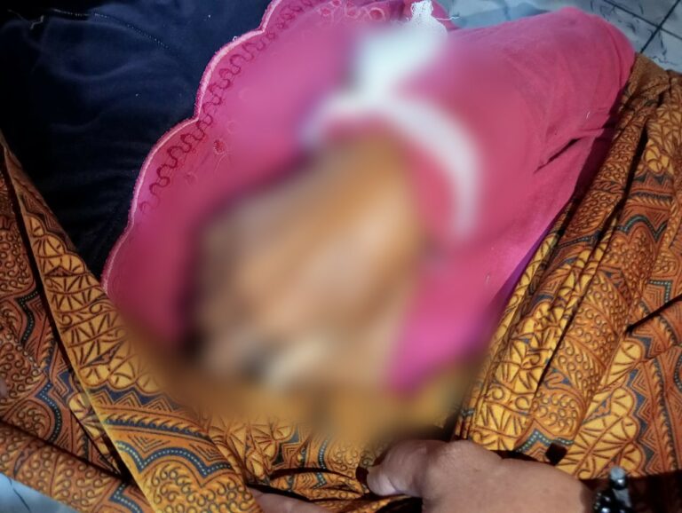 Tangan Korban Tersengat Listrik